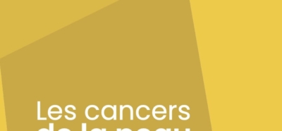 Les Cancers De La Peau